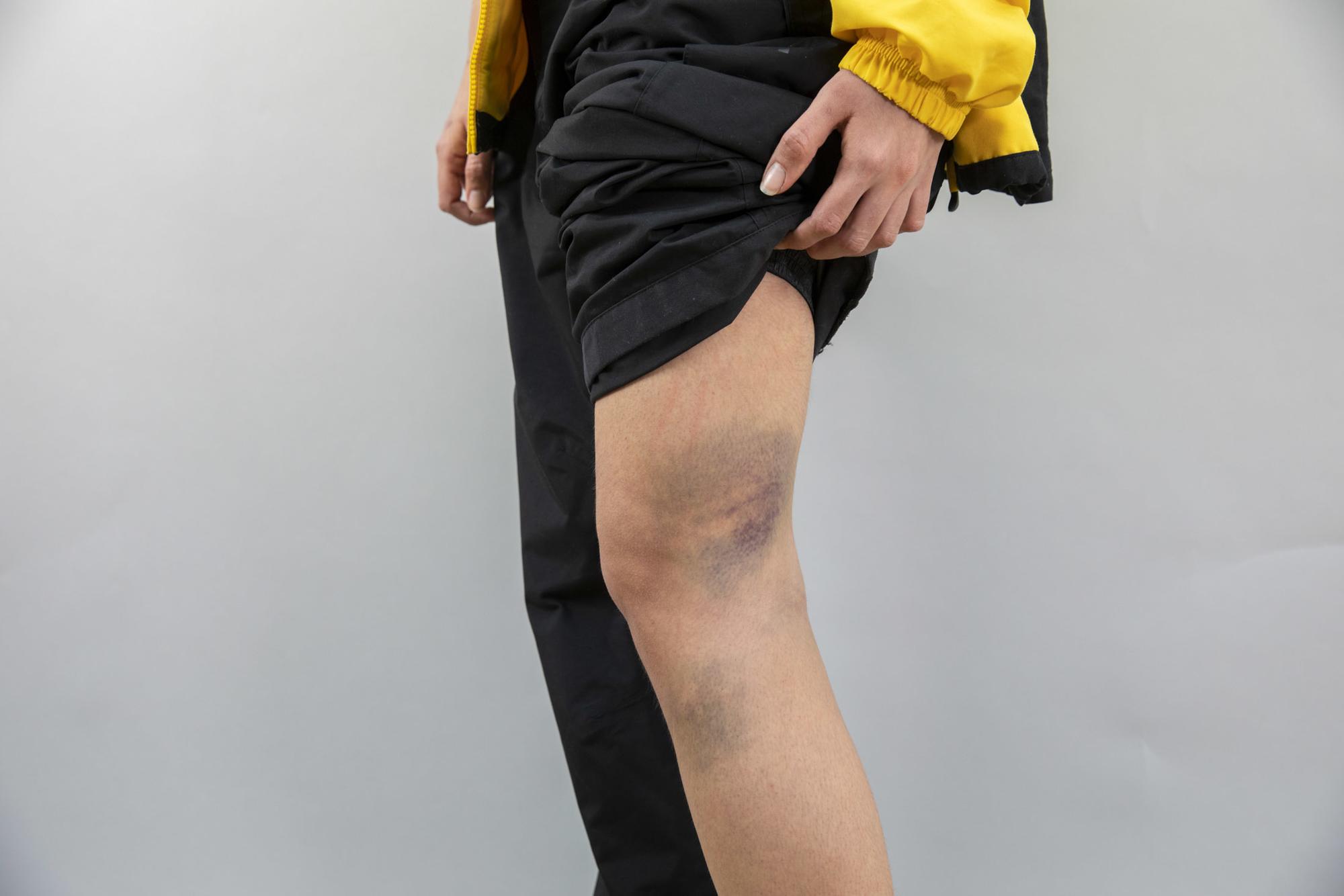 Nuria Lopez agresion policia - 2